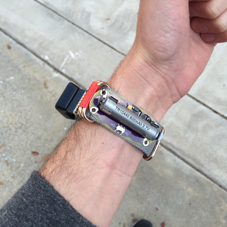 A white left wrist faces the camera (palm facing up). A battery and associated circuit board is attached to the wrist via a grey strap.